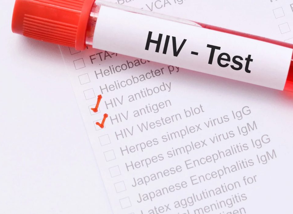 Anonymous and Free HIV Testing Service Launched in Kocaeli