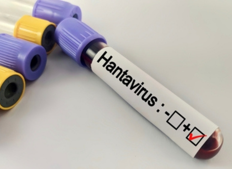 Could Hantavirus Turn Into an Outbreak? Experts Respond