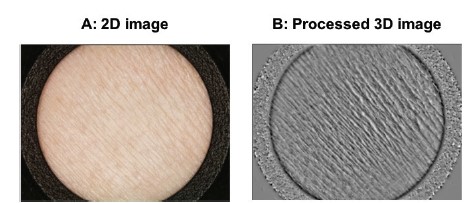 SkinCam®’den elde edilen pürüzlülük analizi görüntüleri